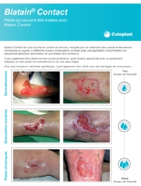 LUX- Biatain Contact application guide