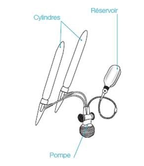 implant pénien